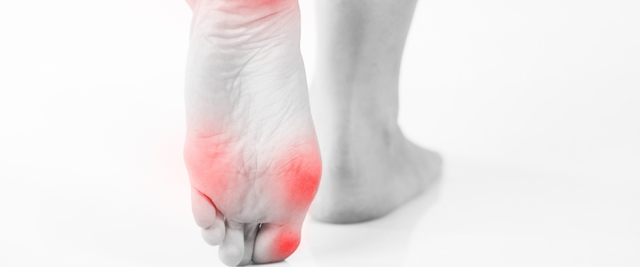 Diabetes and feet – Symptoms of Foot Calluses